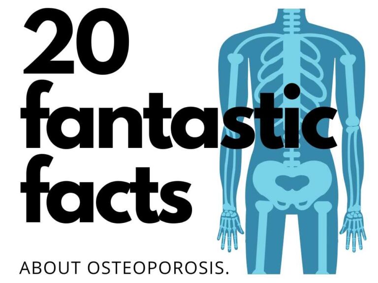 Twenty fantastic facts about osteoporosis