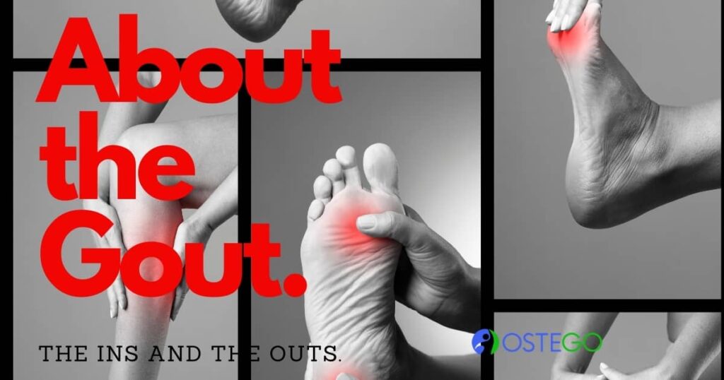 5 Differentiating Between Osteoporosis and Osteoarthritis You Should ...