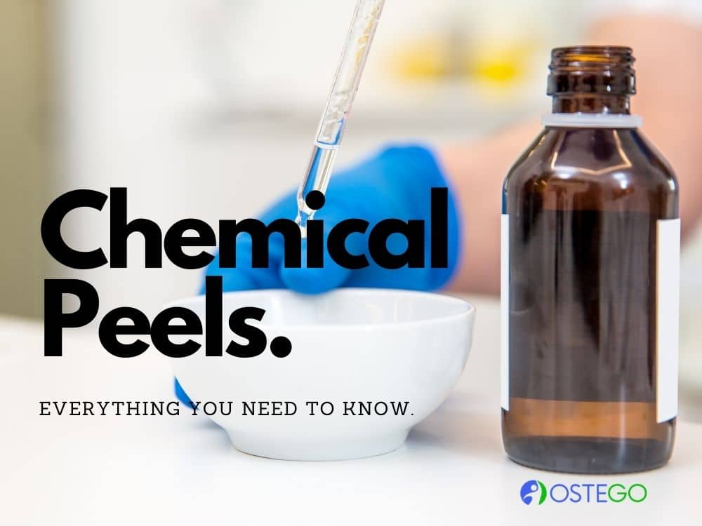 Chemical Peels