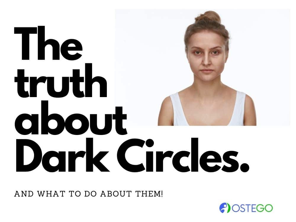 How To Lighten Dark Circles Under Eyes [6 Easy Ways]