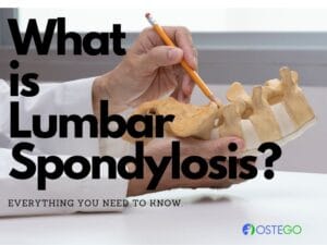Lumbar Spondylosis