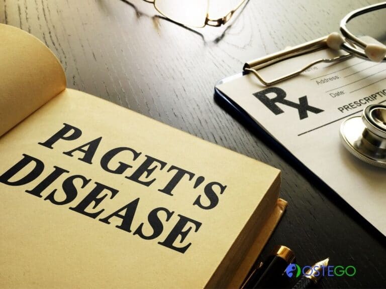 pagets disease